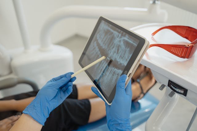 Danties šalinimas prieš ortodontinį gydymą: kada reikia atlaisvinti vietos žandikaulyje